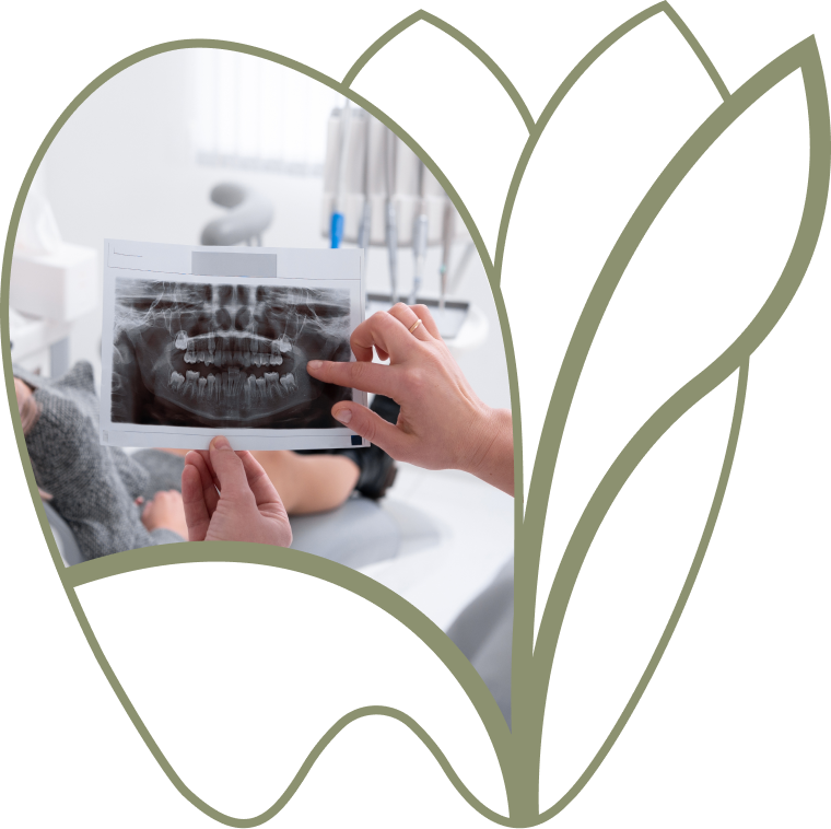 Rendez-vous pour l’évaluation des dents de sagesse avec radiographie, dentiste Douai