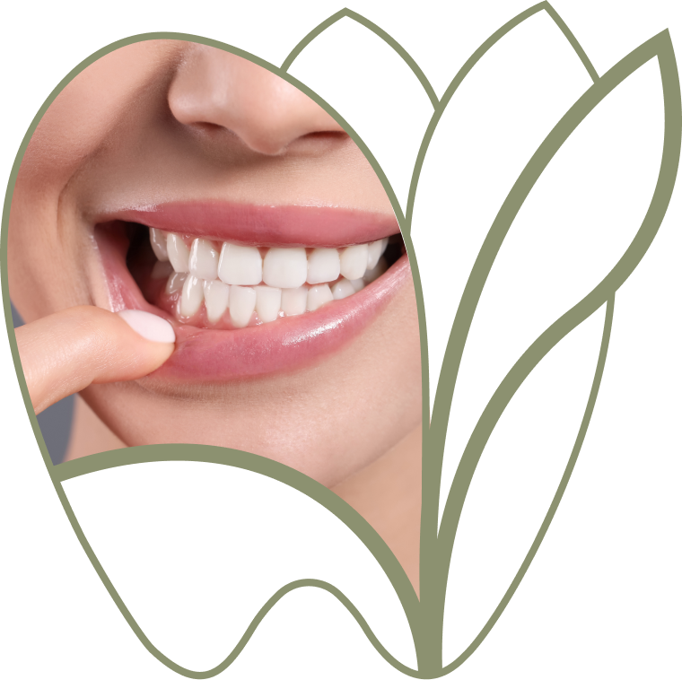 Sourire après une greffe de gencive réussie, dentiste Douai