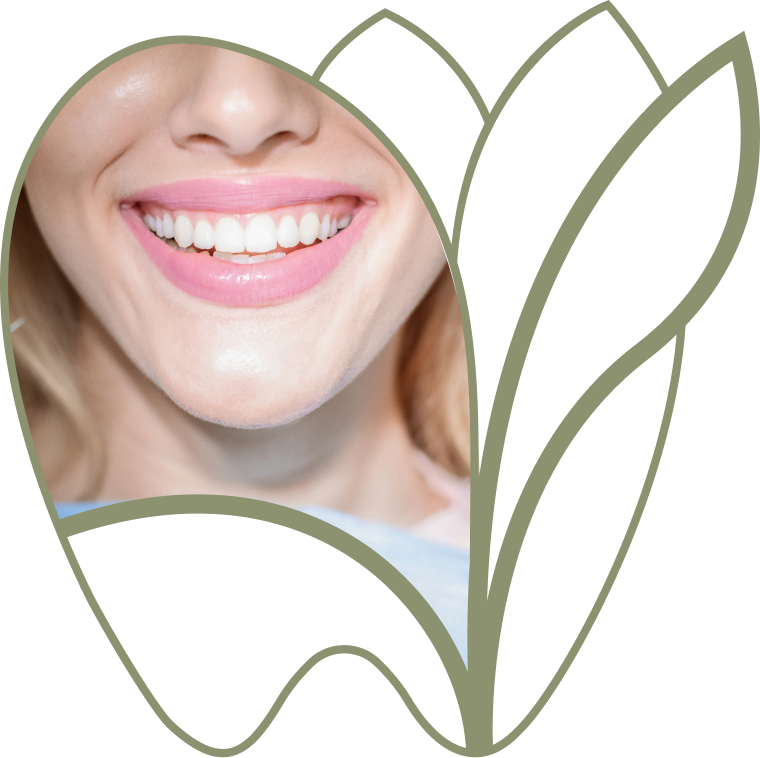 Sourire préservé malgré l’usure dentaire, dentiste Douai